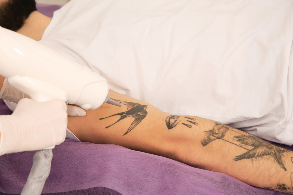 jeune-homme-tatouage