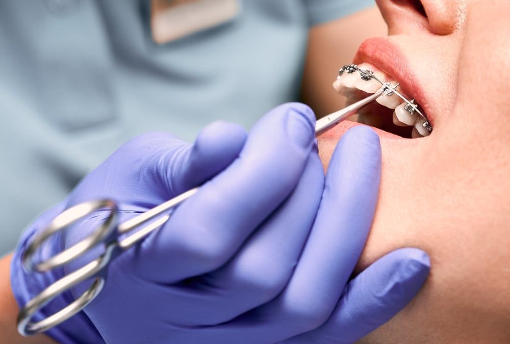 traitement-orthopedique-appareil-dentaire