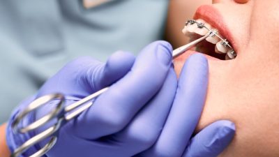 traitement-orthopedique-appareil-dentaire