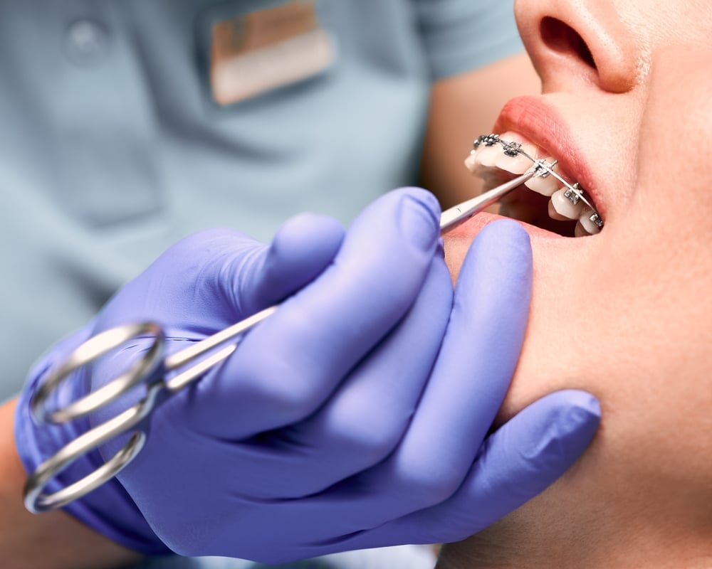 traitement-orthopedique-appareil-dentaire
