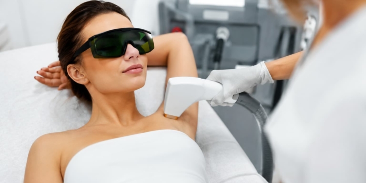 epilation laser questions reponses